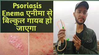 एनीमा को कैसे करे ? |  How to do  Organic Coffee Enema