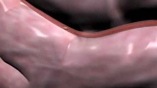 physical symptoms of high blood pressure