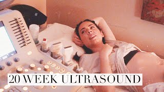 20 Week Pregnancy Anatomy Scan Ultrasound!