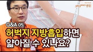 지방흡입 Q&A : 5. 터질듯한 제 허벅지. 지방흡입으로 얇아질 수 있을까요?_365mc병원