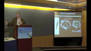 Salvatore Sclafani, MD [Intravascular Ultrasound | CCSVI Symposium 2011 - 25 of 46]