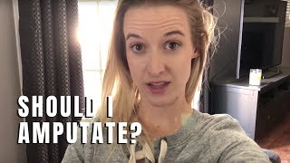 Why do I have to consider amputation?