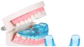 G Tooth trainer для выпрямления зубов обзор