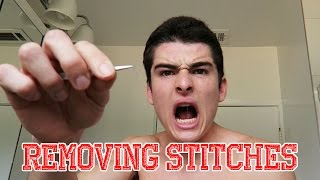 Removing Stitches at Home | June 25, 2015-July 1, 2015