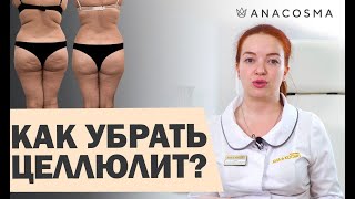 ⭐️КАК УБРАТЬ ЦЕЛЛЮЛИТ ⭐️ на ногах, на попе, в домашних условиях⭐️⭐️