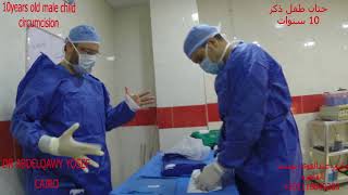 ختان وطهارة طفل ذكر 10سنوات .circumcision of 10years old  male child  دكتور عبدالقوي يوسف