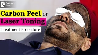 Treating Pigmentation using Carbon Peel | Laser Toning Treatment Video - Dr. Rajdeep Mysore