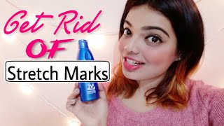 Get Rid of stretch marks at home.