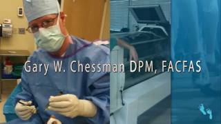 Hammertoe Procedure by Gary W. Chessman DPM, FACFAS