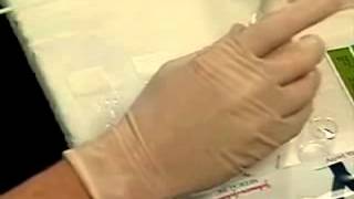 PAP test ПАП тест мазок smear