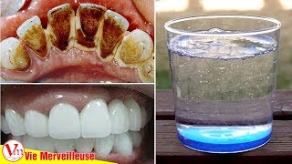 Formule Secrète De Dentiste Chinois: Enlever La Plaque Dentaire En 2 Minutes Avec Ce rince-bouche