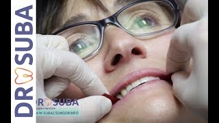 Prothèse fixe sur implant Refaire toutes ses dents Le travail du dentiste