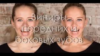Виниры передних и боковых зубов. Esthet-X HD (Dentsply Syrona). Front teeth veneers.