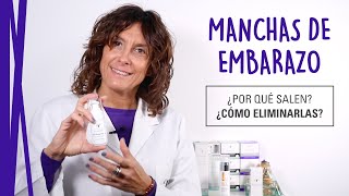 MANCHAS de EMBARAZO | Cómo eliminarlas y POR QUÉ se producen