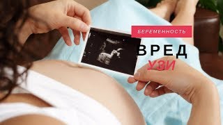 Вред УЗИ при Беременности | Вред и Польза УЗИ | Влияние УЗИ на Плод