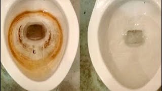 Мощный способ!Как очистить унитаз от мочевого  камня и известкового налёта