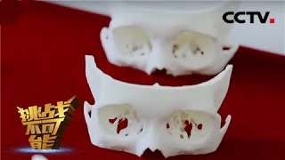 [挑战不可能 第三季]3D打印显神威 300小时1比1还原30位挑战助理眼眶骨 | CCTV挑战不可能官方频道
