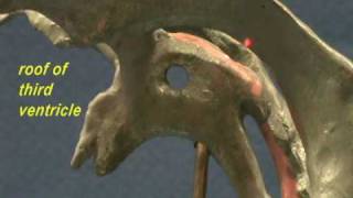 Ventricle Model