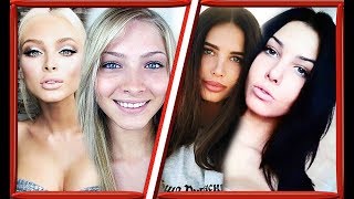 12 звезд российского Instagram До и После пластики/Решетова, Шишкова, Самойлова и др.