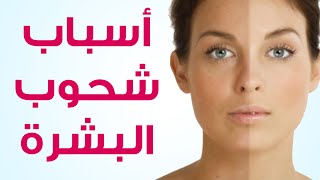 #تعرف على أسباب شحوب البشرة