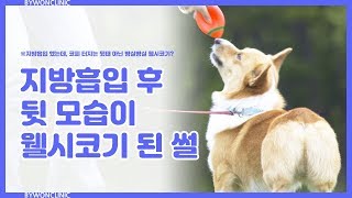 [바이원클리닉] 지방흡입 후 엉덩이 선은 내려오고, 다리는 짧아졌다?