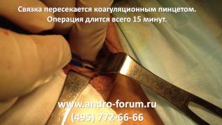 Лигаментотомия