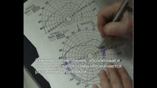 Поля зрения - методика определения