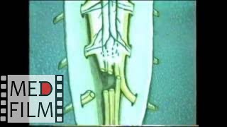 Хирургия травмы спинного мозга © Surgery spinal cord injury in the acute period