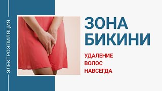 Электроэпиляция бикини