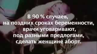 Аборт в подробностях
