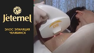 Элос эпиляция Челябинск