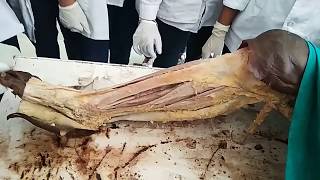 Lower Limb Muscles Dissection | Dissection Of Lower Limb | Anatomy Lecture | Postmortem | Dr Lucky |