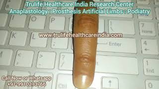 Prosthetic Finger | Artificial Finger | Finger Prosthesis | Silicone Finger | Fake Finger | Finger