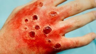 10 Diseases That Will Kill You In A Day