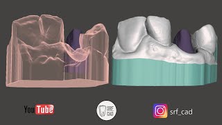 MESHMIXER DENTAL MODEL CREATOR TUTORIAL  moncone sfilabile