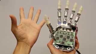 Amputee feels in real time with bionic hand
