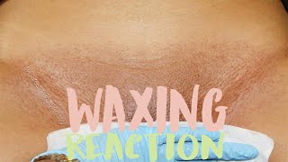 FULL BIKINI WAX! Another Reaction | Waxing your butt is painful?