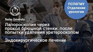 Лапороскопия через прокол брюшной полости | Гаджиев Нариман Казиханович, уролог-хирург