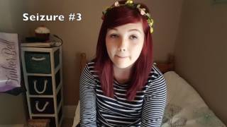 Absence Seizure Caught on Camera