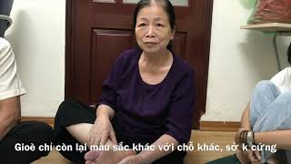 5 MẸO ĐƠN GIẢN ĐÁNH BAY CHAI CHÂN TRONG 7 NGÀY.