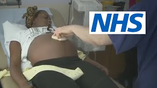 My baby is breech. What help will I get? | NHS