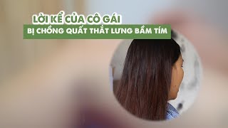 Xót xa lời kể cô gái Tây Ninh bị chồng quất thắt lưng bầm tím trước mặt cha mẹ
