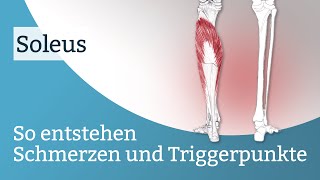 Soleus Schmerzen, Triggerpunkte und deren Aktivierung