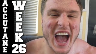Attackutane Week 26 - Restrategizing and Upping My Fats!