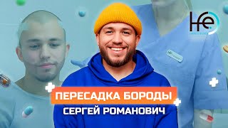 Интервью после пересадки бороды. Сергей Романович | HFE Clinic (6+)