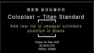 발기부전 팽창형 음경임플란트 - 비대칭 음경해면체 케이스(Coloplast Titan) Add rear tip in Unequal cylinders position in Glans