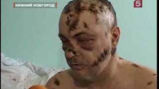 ЖЕНА ИЗРУБИЛА МУЖА ТОПОРОМ