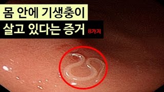 (랭킹박스) 몸 안에 기생충이 살고있다는 증거 8가지