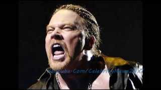 Axl Rose Plastic Surgery Before and After