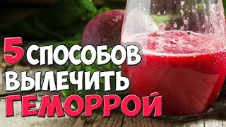 Как Лечить ГЕМОРРОЙ? ✅5 Способов Лечения ГЕМОРРОЯ в Домашних Условиях